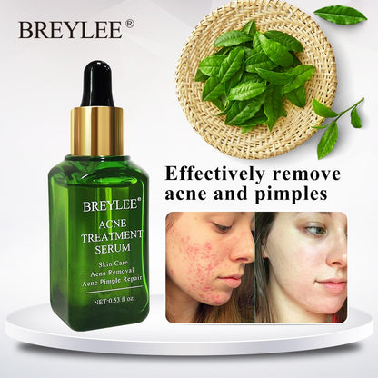 BREYLEE Acne Treatment Serum - Acne Scar Repair & Blemish Care